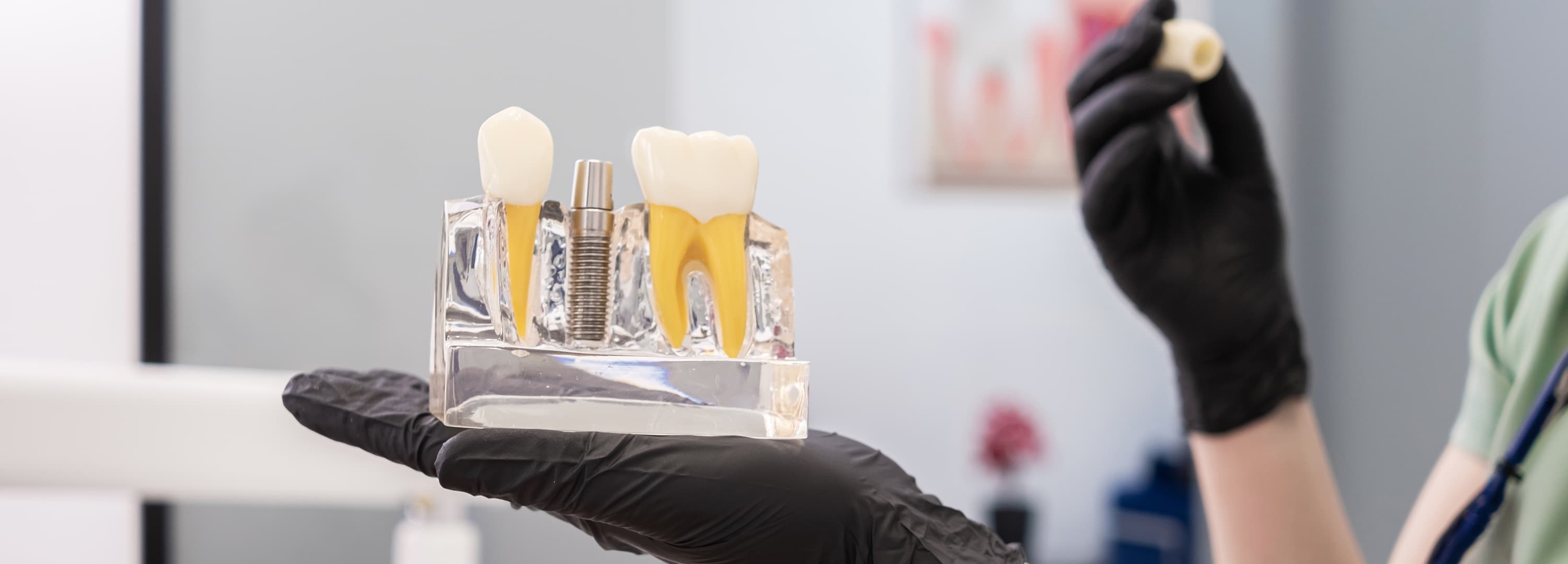 Dental model showing a crown and implant between natural teeth