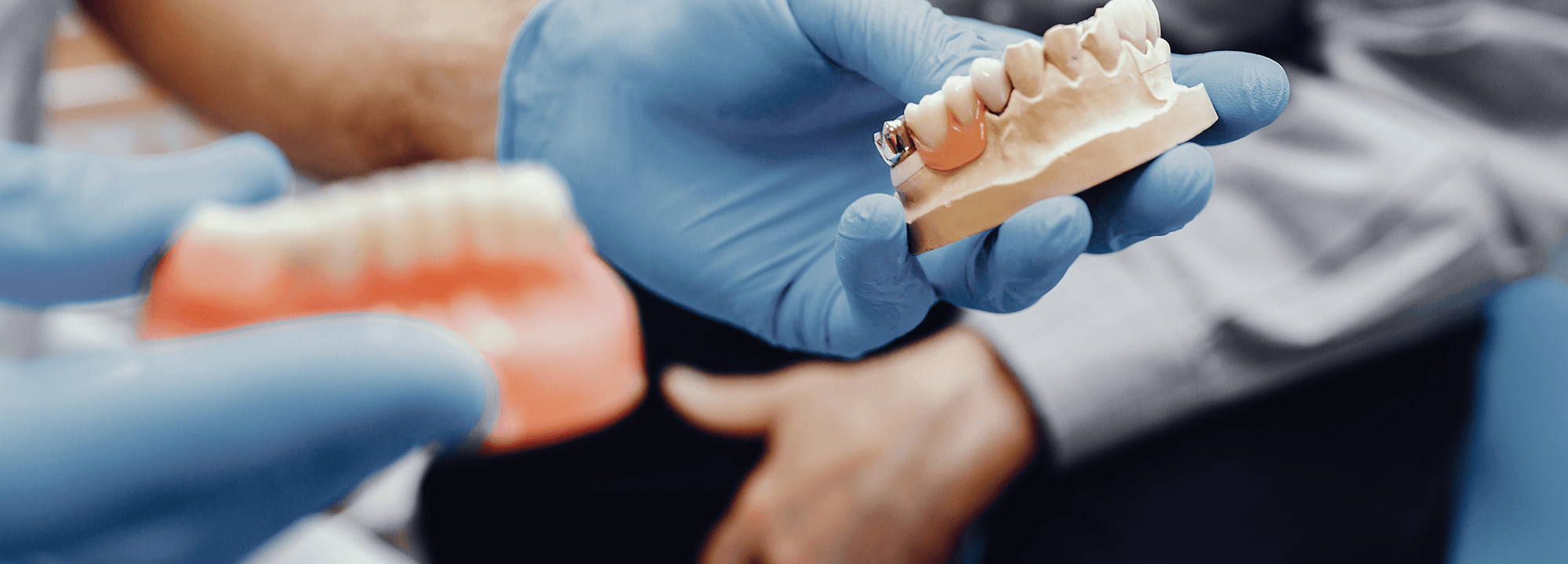 Dental implant consultation in a modern dental office