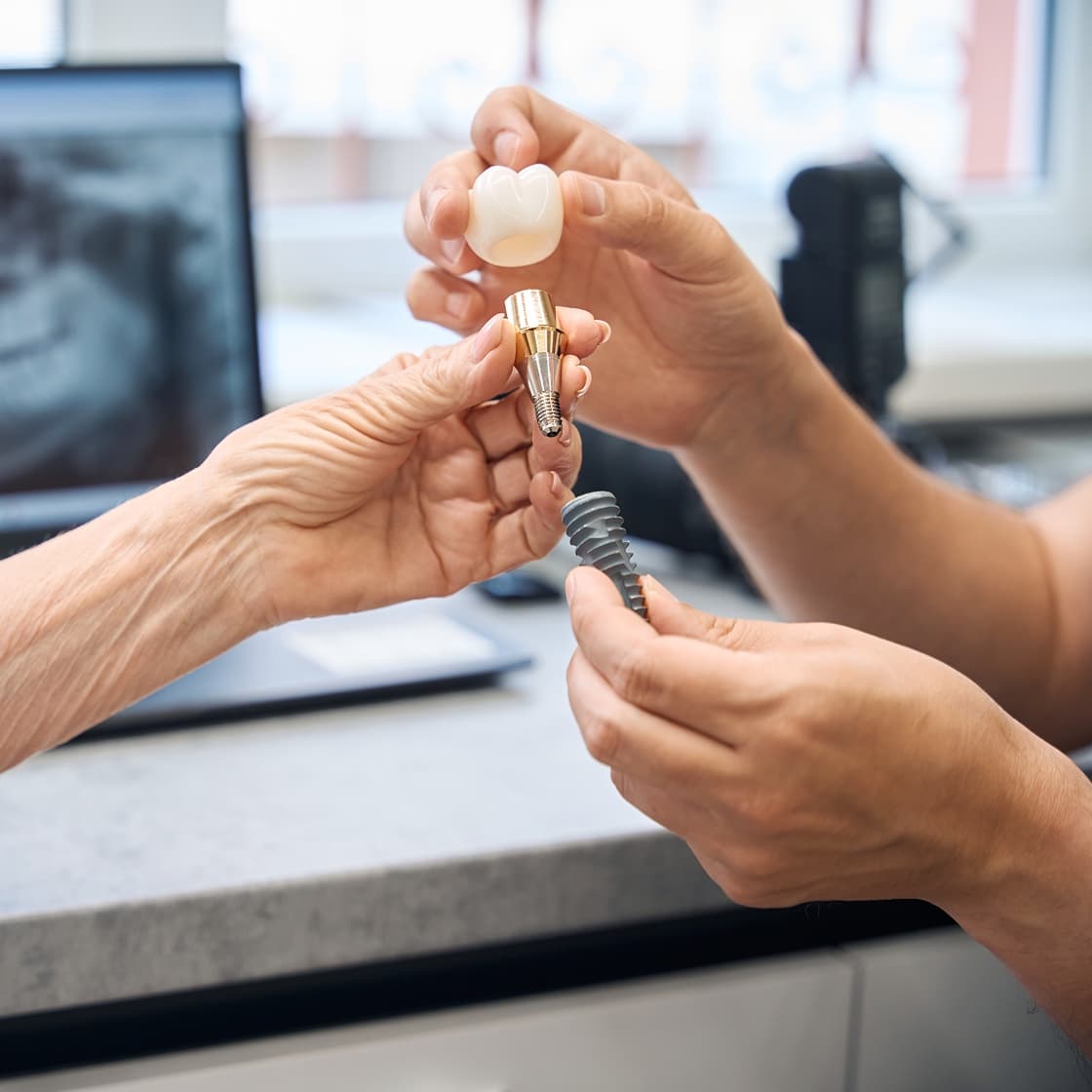 Dental implant, abutment and crown shown to a patient