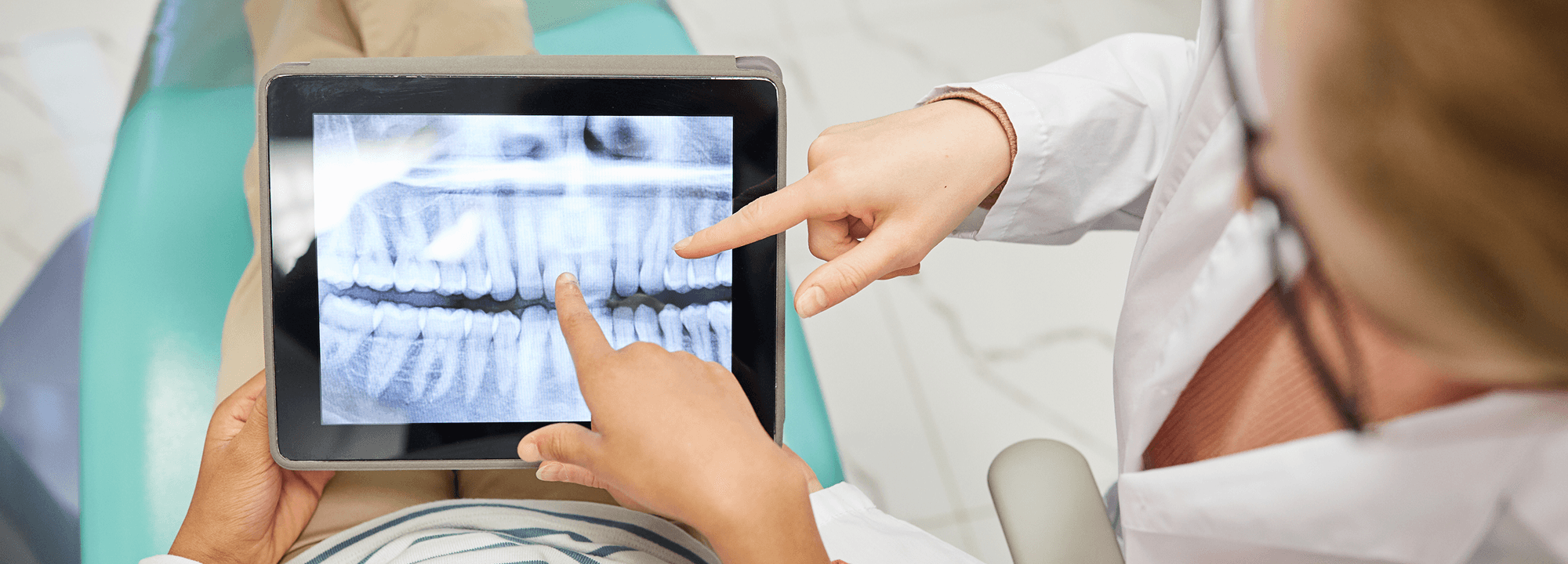 Patient and dentist reviewing a digital dental X-ray on a tablet