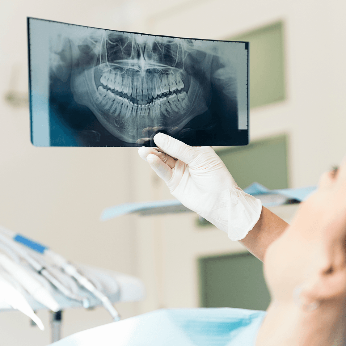 Gloved hand holding up a panoramic dental X-ray for a patient in the dental chair